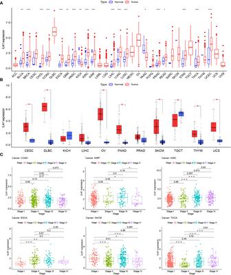 IL4I1 in M2-like macrophage promotes glioma progression and is a promising target for immunotherapy